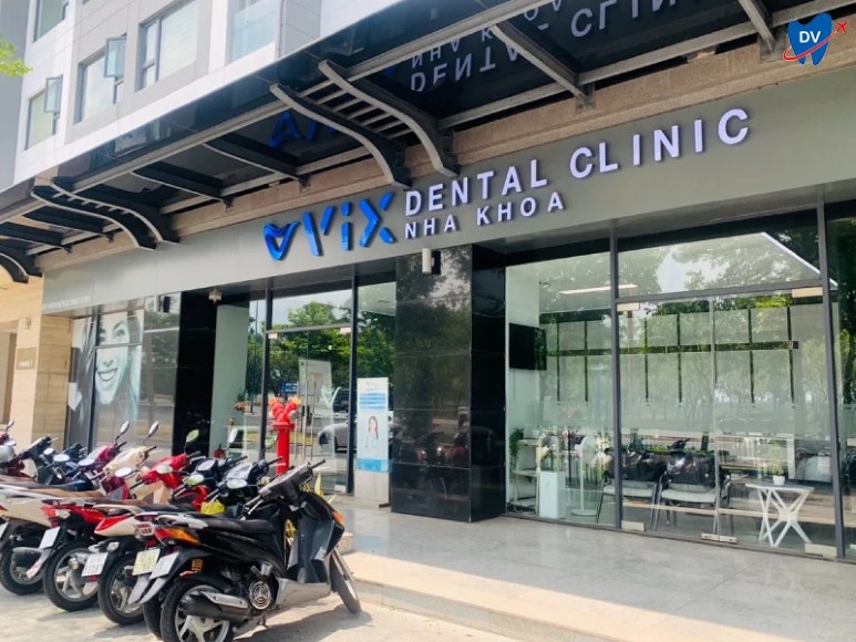 niềng răng mắc cài kim loại Nha Khoa VIX