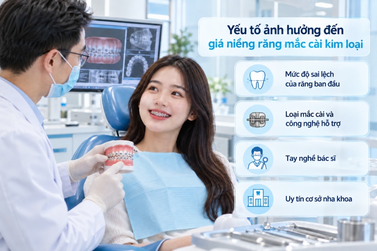 yếu tố ảnh hưởng đến giá niềng răng mắc cài kim loại